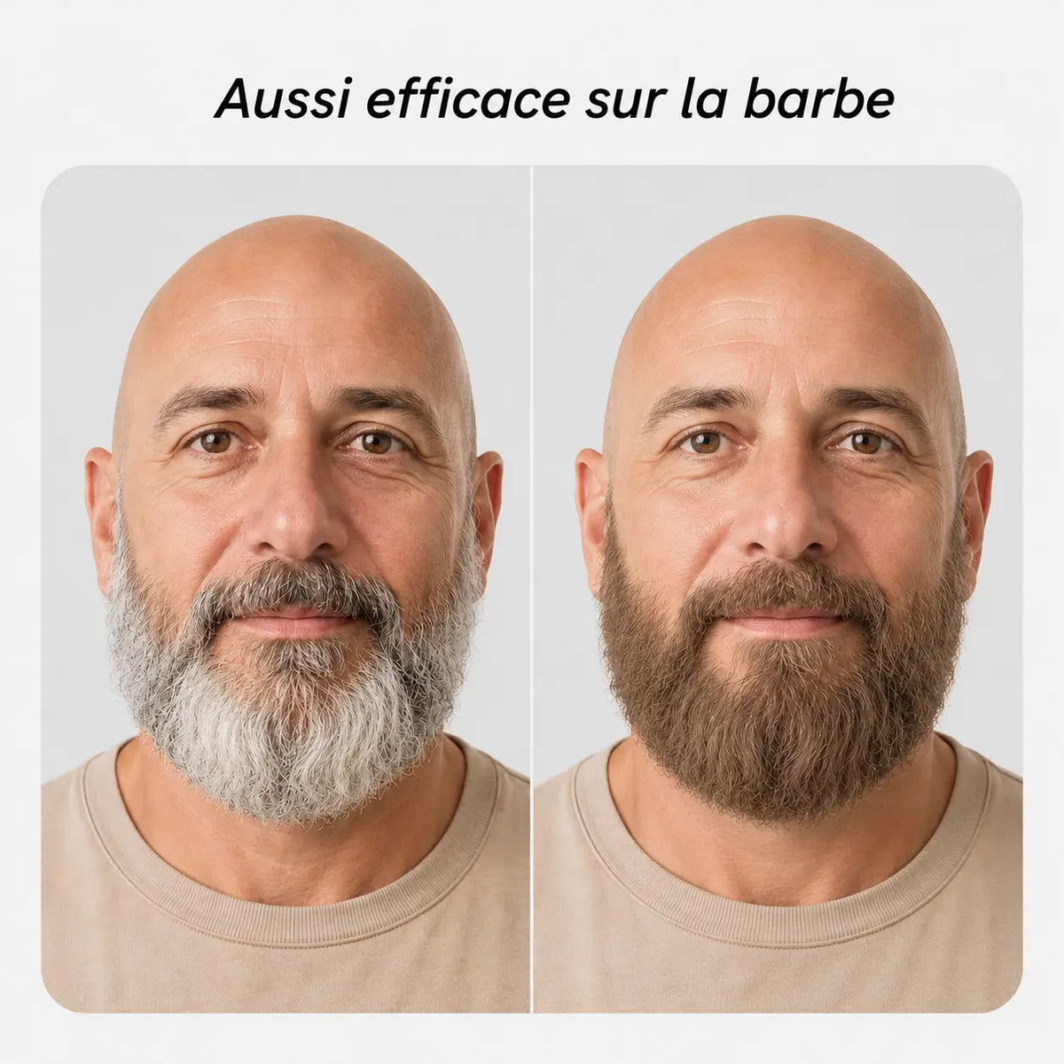 Résultat sur barbe #Couleur_Châtain